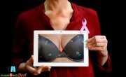 Computeres mammográfiai vizsgálat gyorsan, fájdalommentesen, sugárterhelés nélkül! Előzd meg a bajt!